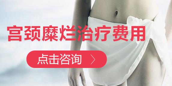 宫颈费用